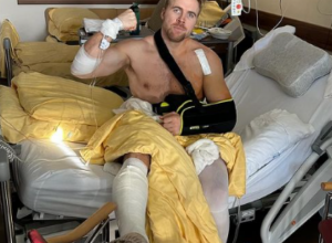 NIJE ZA ONE SA SLABIM STOMAKOM Poznati sportista pokazao strašne povrede posle pada  (UZNEMIRUJUĆI FOTO)