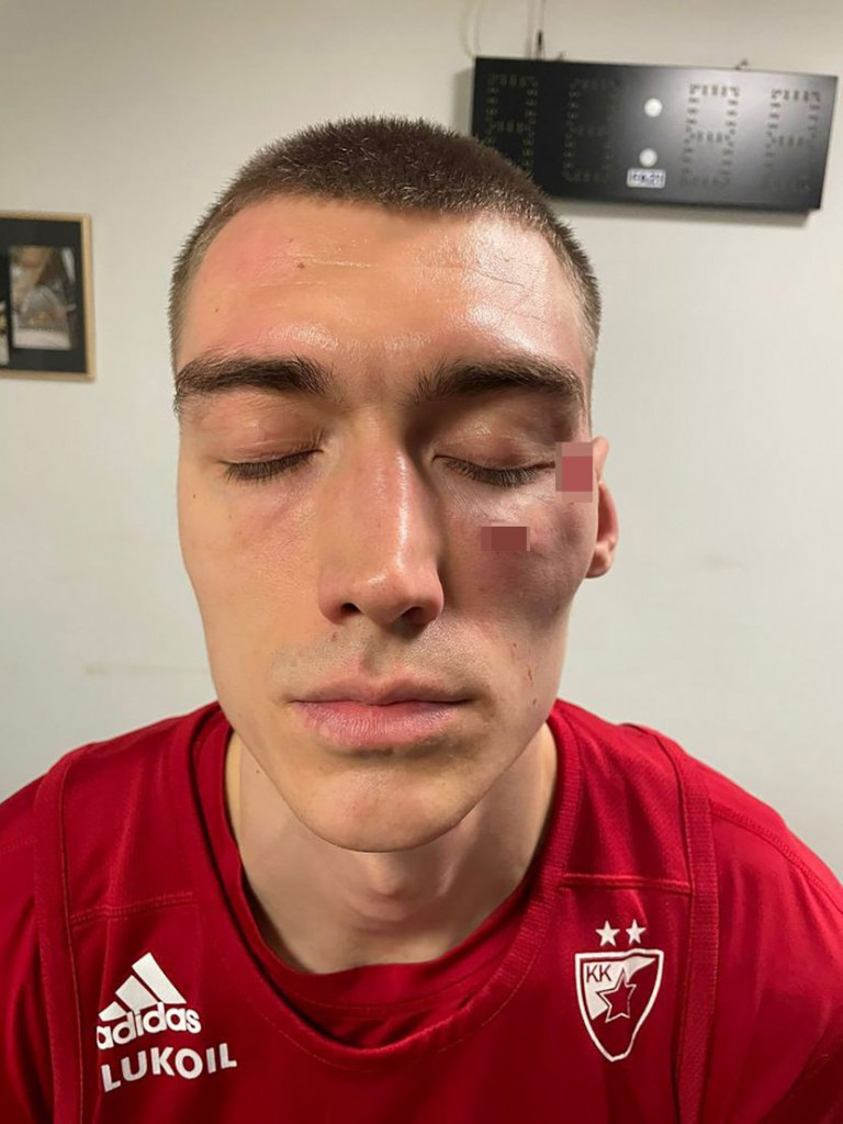 BURA OKO INCIDENTA U ARENI SE NE STIŠAVA Evo šta su Naneli i Lazarević rekli u policiji posle skandala uoči treće finalne utakmice