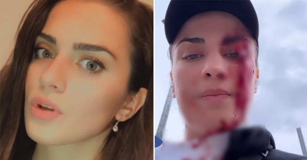 UZNEMIRUJUĆI SNIMAK Lepa bokserka brutalno pretučena ZBOG ŠORCA?! Jedva je izvukla živu glavu (VIDEO)