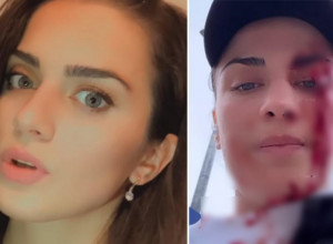 UZNEMIRUJUĆI SNIMAK Lepa bokserka brutalno pretučena ZBOG ŠORCA?! Jedva je izvukla živu glavu (VIDEO)
