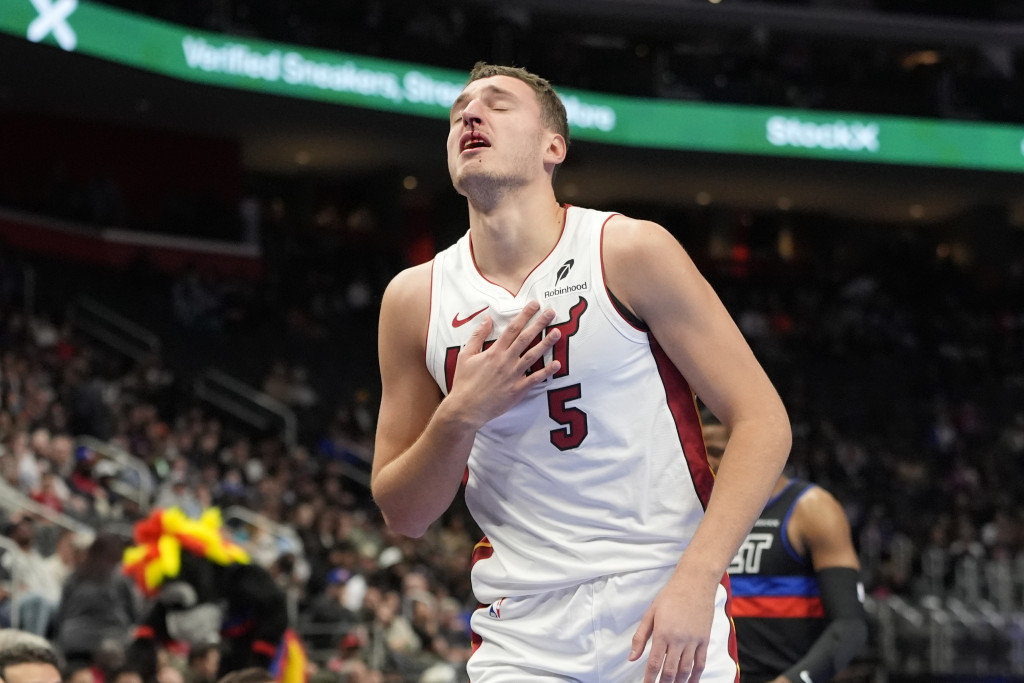 KRVAV NAPUSTIO TEREN Košmarna noć za reprezentativca Srbije u NBA - poraz i slomljen nos (VIDEO)