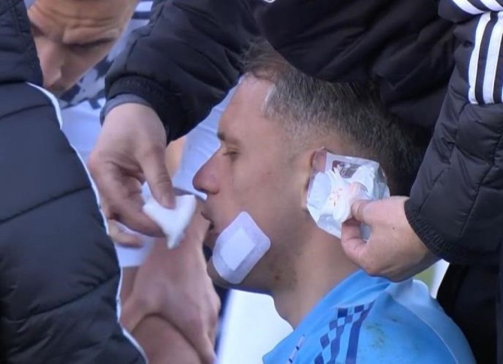 DIVLJAČKI START U DERBIJU HRVATSKE Fudbaler Dinama umalo teško povredio golmana Hajduka, ovako nešto nije za svačiji stomak (VIDEO)