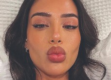 KRALJEVSKE MUKE Belingema i dalje boli butina, a devojka pozira u sobi!