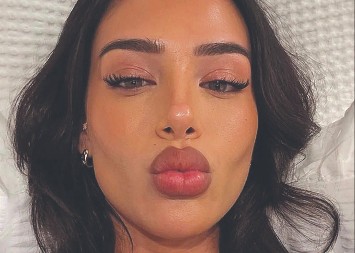 KRALJEVSKE MUKE Belingema i dalje boli butina, a devojka pozira u sobi!