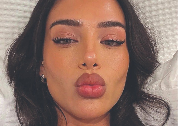 KRALJEVSKE MUKE Belingema i dalje boli butina, a devojka pozira u sobi!