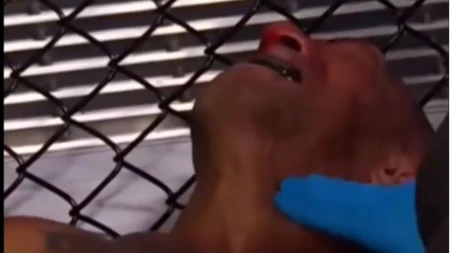 Uznemirujuće: UFC borac ležao nepomično, kolabirao za vreme borbe